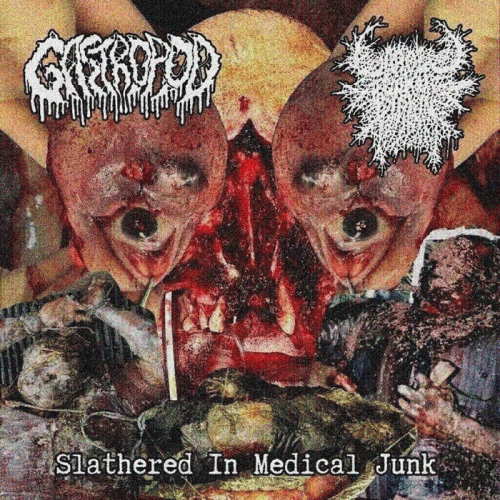 Gastropod : Slathered in Medical Junk